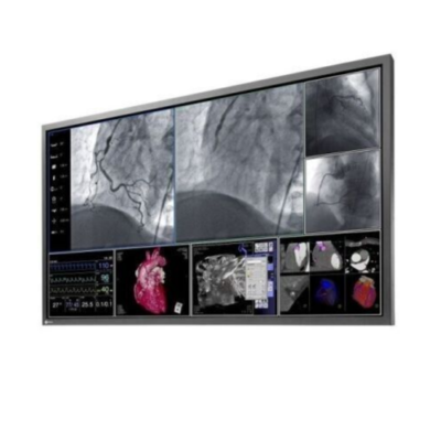 Eizo Radiforce LS580W Cath Lab MONITOR 6GF6200-8AB01 58