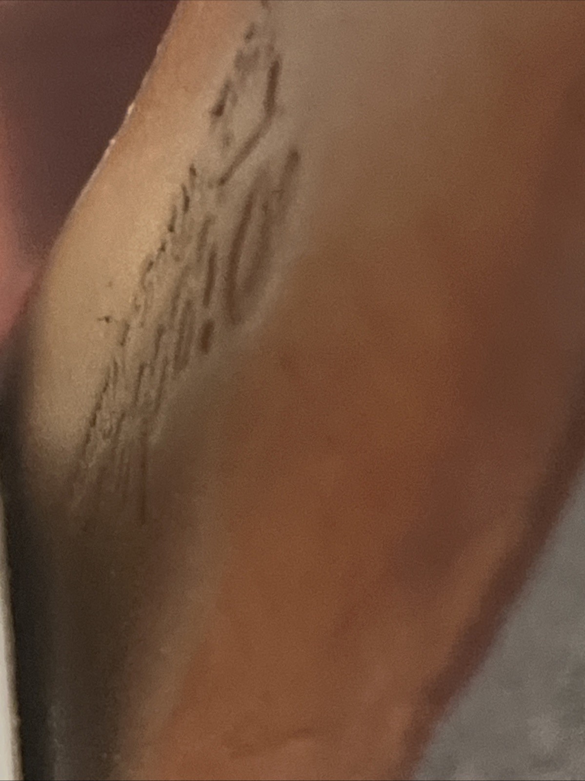 Picture 10 of 17