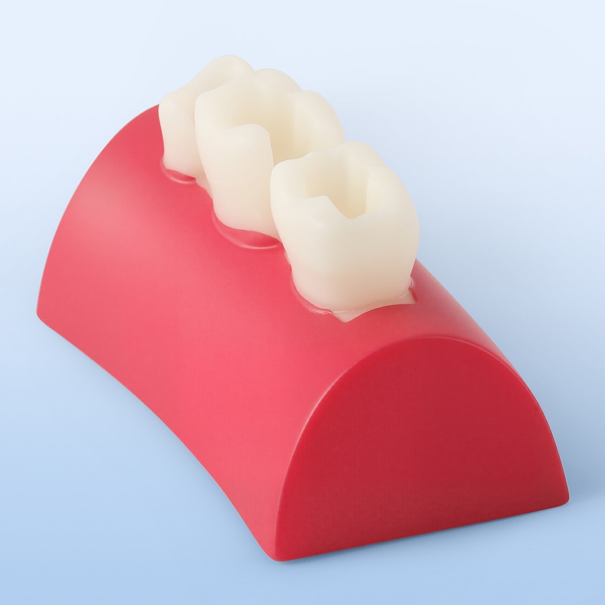 Portable Dental Mobile Digital X Ray Machine High Frequency+Non Shield/Sensor