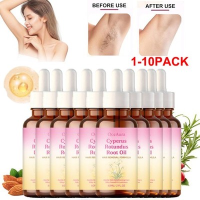 8/10 Pack Cyperus Rotundus Oil for Hair Removal Reducing Body Hair Growth 60ml
