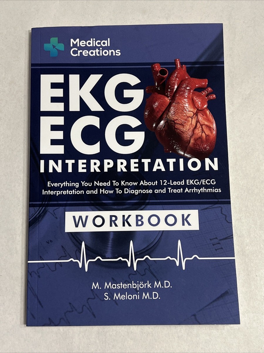 EKG/ECG Interpretation: Everything you Need to Know about the 12