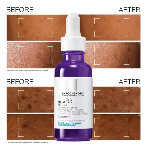 LA ROCHE-POSAY - Sérum Mela B3 30ml | Éclat & Anti-Taches - Neuf - Foto 5 di 7