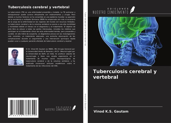 Vinod K. S. Gautam | Tuberculosis Cerebral Y Vertebral | Taschenbuch | Spanisch-image