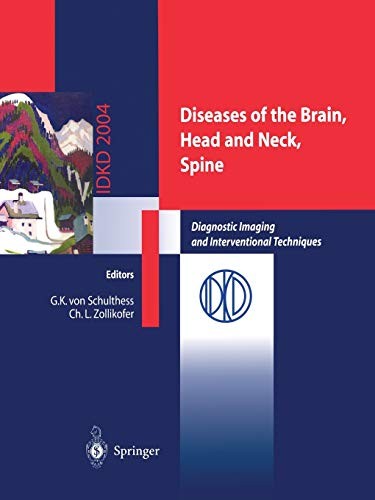 Diseases of the Brain, Head and Neck, Spine: Di. K.Schulthess, L.Zollikofer**