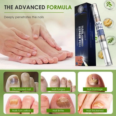 Household Gentle Nail Care 4pcs Nail Fungal Liquid Repair Essence Pen
