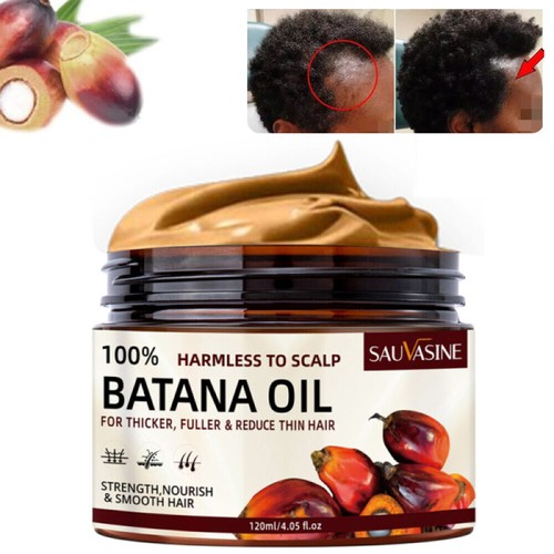 Natural Batana Oil Serum for Hair Growth Healthier Thicker Repair Damaged Hair - Picture 20 of 34