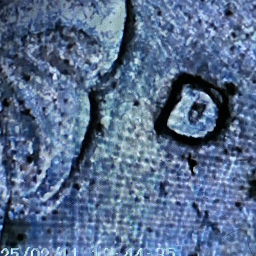 1776-1976 D BICENTENNIAL QUARTER DOUBLE DIE OBVERSE & REVERSE ERROR! - Picture 8 of 14