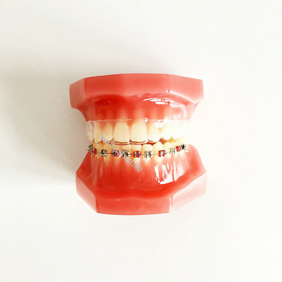 Dental Ortho Teeth Treatment Model Invisible Metal Alignment Trainer Retainer