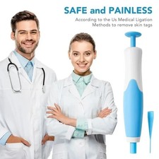 Auto Micro Skin Tag Remover Device Kit Safe Painless Removal Band Tool