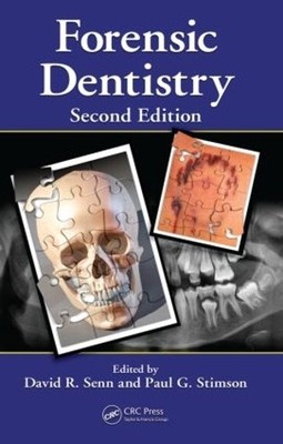 Forensic Dentistry - 9781420078367