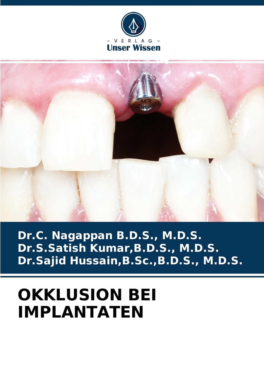 Thumbnail - Okklusion Bei Implantaten, M. D. S. B. D. S.