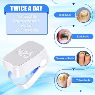 DE~Laser Nagelpilz Fungal Nail Therapie Lasergerät Fungus Lazer-für Heimgebrauch