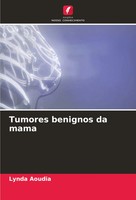 Lynda Aoudia | Tumores Benignos Da Mama | Taschenbuch | Portugiesisch (2024)