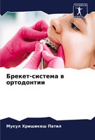 Mukul Hrishikesh Patil | Breket-Sistema W Ortodontii | Taschenbuch | Russisch