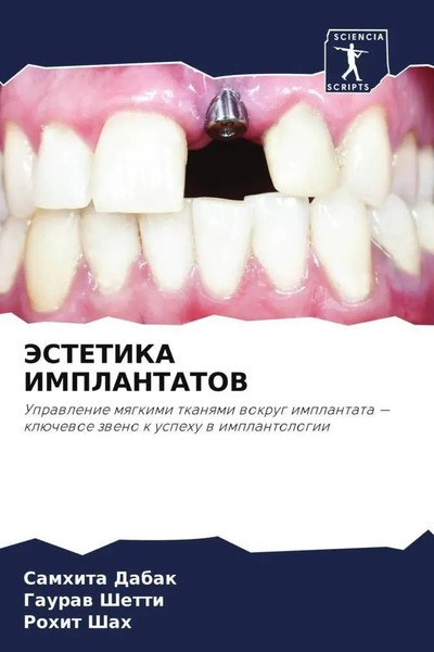 Samhita Dabak (U. A.) | Jestetika Implantatov | Taschenbuch | Russisch (2022)-image