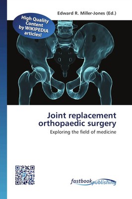 Edward R. Miller-Jones | Joint replacement orthopaedic surgery | Taschenbuch