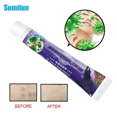 SUMIFUN 20g New Natural Herbal Essence Wolf Skin Care Herbal Cream All Body Anti Itching