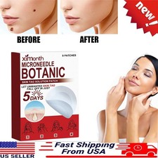 MICRONEEDLE 1/2Box BOTANIC Skin Tag  Acne Patch Skin Tag Remover Patches