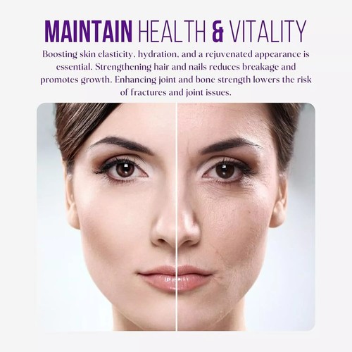 Sunberg 1000mg Multi Collagen Peptide Supplement Type I, II, III Liquid Shots - Picture 17 of 32