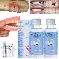 2X Tooth Repair Kit - Temporary Teeth Replacement Kit for Missing & Broken Teeth