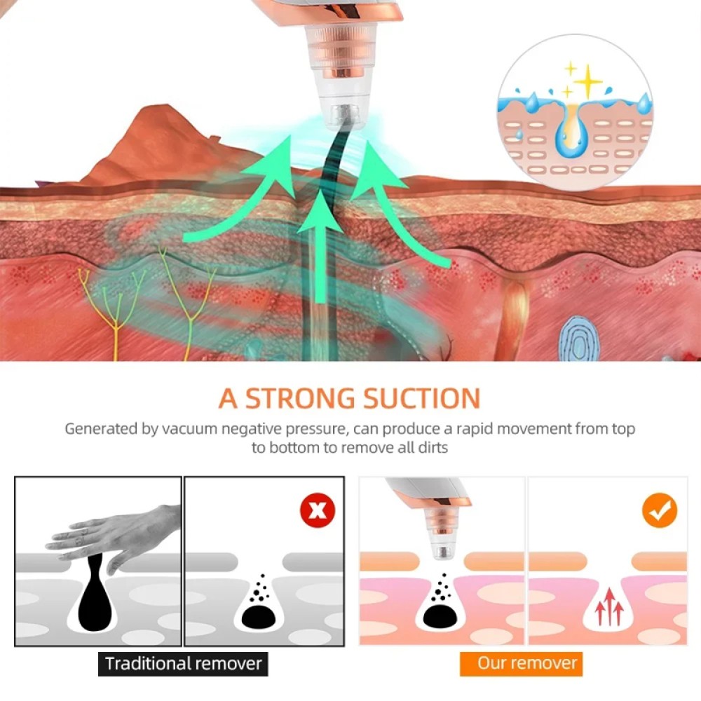 Electric Blackhead Remover Pore Nose Sucker Pimple Skin Acne Face Cleaner Vacuum