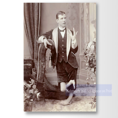 Odd Weird -Vintage  The Lobster Boy, Carnival Circus Sideshow  Photo Print