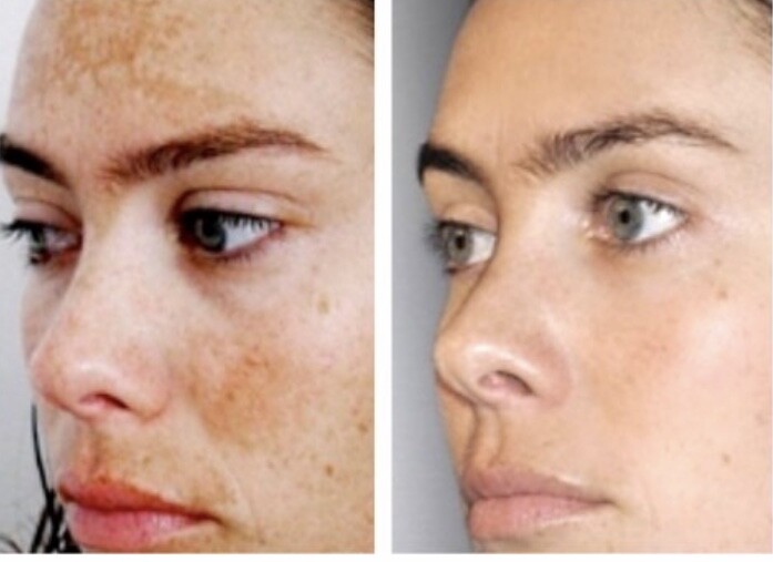 Skin Whitening Lightening Serum ,Dark Spot Corrector