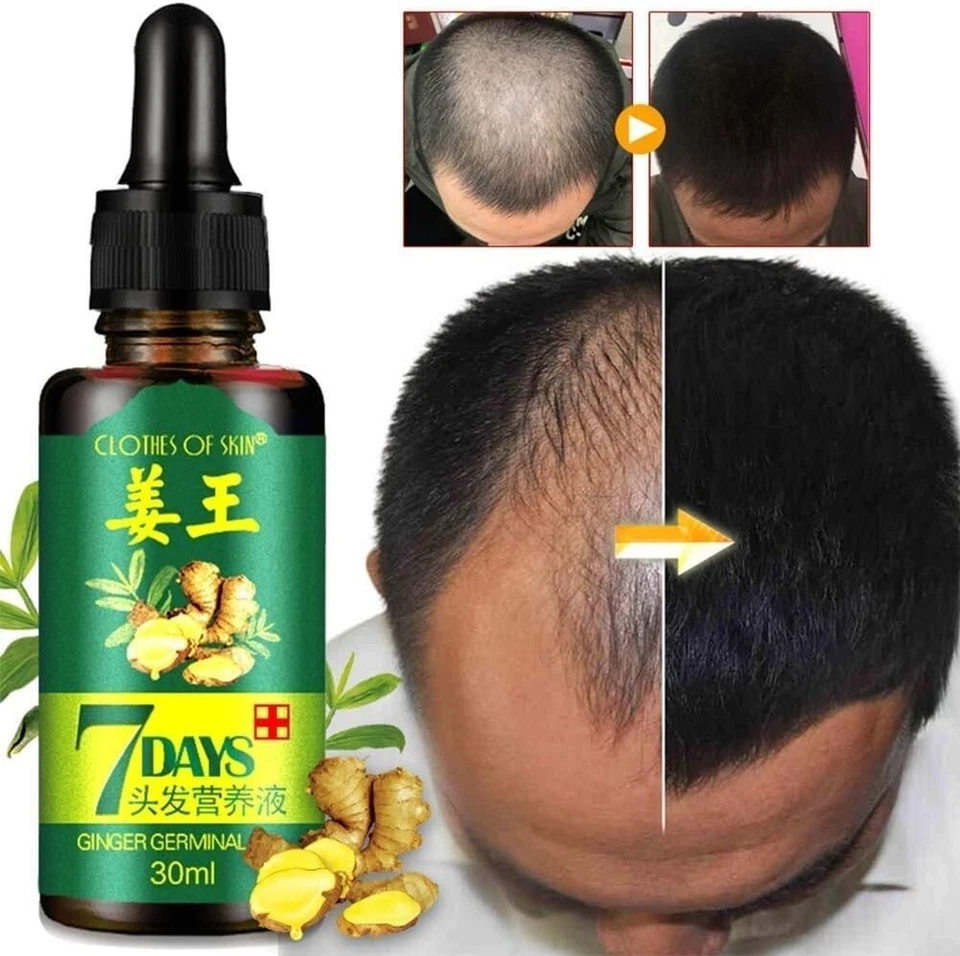 THE ISMA 7 Days Hair Growth Serum Oil, Hair Regrowth Serum, Ginger Germinal Oil X 3 btls