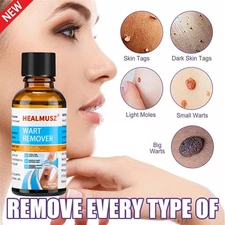 HEALMUSZ Wart Remover Liquid Plantar Wart Removers for Feet Body Fast Acting