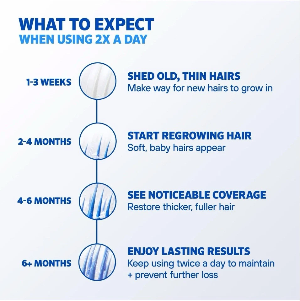 ROGAINE 5% Minoxidil Masculino Espuma Sem Perfume Tratamento de Crescimento de Cabelo Pacote com 3 - Imagem 3 de 3