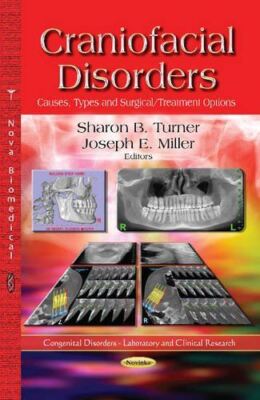 Craniofacial Disorders: Causes, Types and Surgical  Treatment