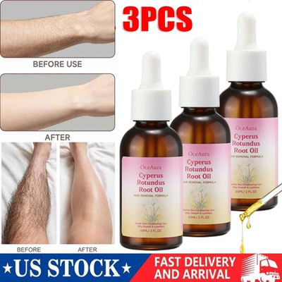 #ad #ad 3PCS Cyprus Oil for Hair RemovalOrganic Cyperus Rotundus Oil for Reducing Body $16.95