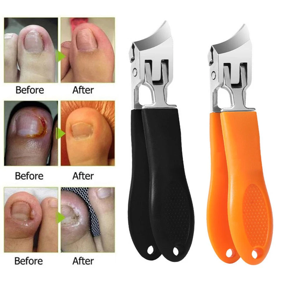 Cortaúñas Curvas Anti-Salpicaduras Gruesas Anchas Cortaúñas Apertura Mandíbula Uña del pie⇓ Foto 4 de 4