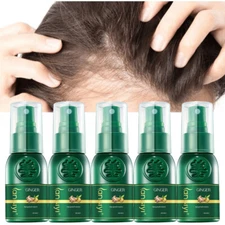 5 x Ginger Hair Growth Spray Fast Regrowth Herbal Anti Hair Loss Treatment Serum