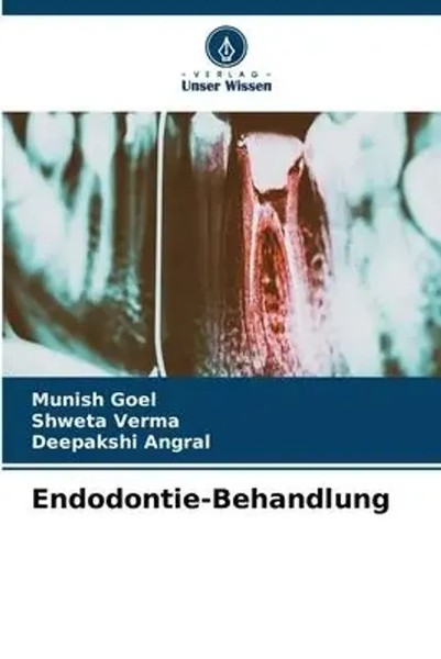 Munish Goel (U. A.) | Endodontie-Behandlung | Taschenbuch | Deutsch (2023)-image