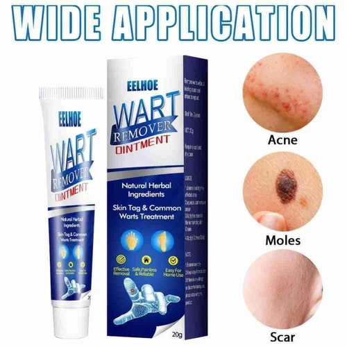 Warzen Entfernung Haut Tag Behandlung Creme Wart Remover Warze Entferner - Bild 7 von 21