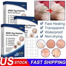 720PCS Skin Tag Remover Patches Quick Effective Mole Wart Removal Pad Sticker