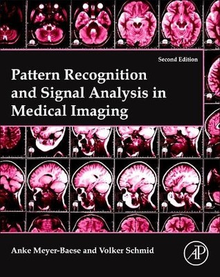 Pattern Recognition and Signal Analysis in Medical Imaging by... - 9780128101162