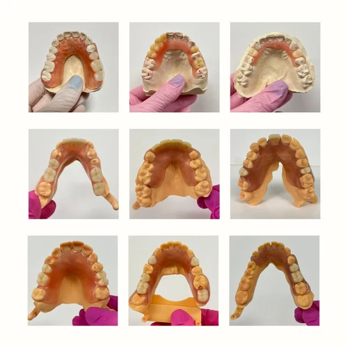 Smile Boutique NY Partial Dental Dentures