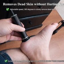 Upgraded Electric Callus Remover for Feet Adjustable Speed Black