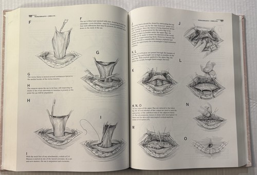 Atlas Of Surgical Techniques By Steven G. Economou (1996) - Picture 10 of 16