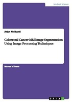Colorectal Cancer Mri Image Segmentation Using Image Processing Techniques Arjun