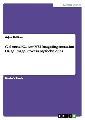 Colorectal Cancer MRI Image Segmentation Using Image Processing Techniques Arjun