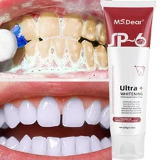 SP-6 Ultra Brightening Probiotics Toothpaste - 120g Sensitive Teeth Whitening