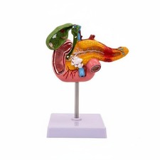 Digestive System Pathology Model Long-Lasting PVC Material for Classroom