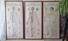 Set Of 3 Acupuncture Point Framed ILLUSTRATIONS