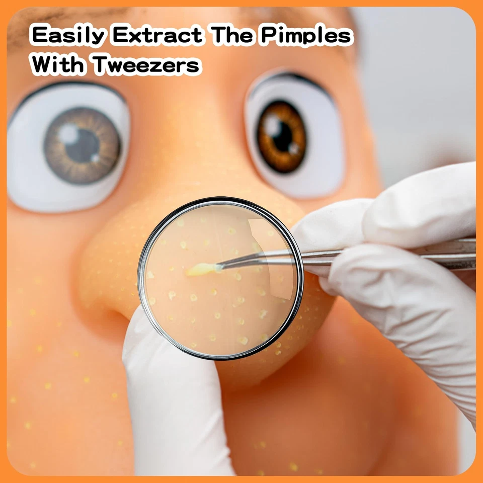 2026 New Pimple Popping Stress Relief Toy – Refillable Big Head Squeeze Pimpl... - Image 2 of 4
