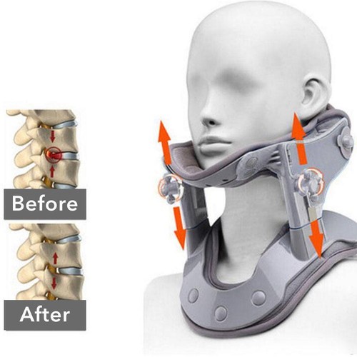 Cervical Neck Traction Device Multifunctional Electric Neck Stretcher V3R3UK- - Bild 8 von 9
