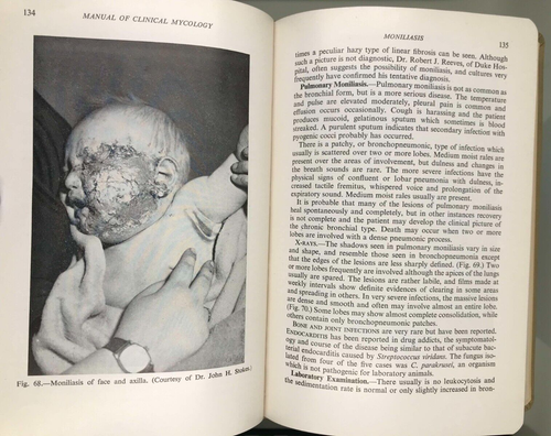 Manual Of Clinical Mycology - 1946 - Illustrated with many graphic photographs - Picture 18 of 24