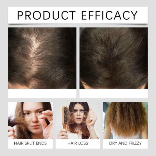 1*30ml Rosemary Hair Oil for Hair Growth Oil, Stop Hair Loss - Hot - Picture 15 of 15